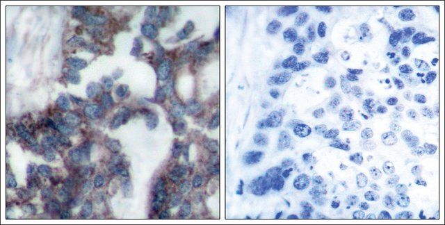 Anti-RPS6KB1 (Ab-424) antibody produced in rabbit