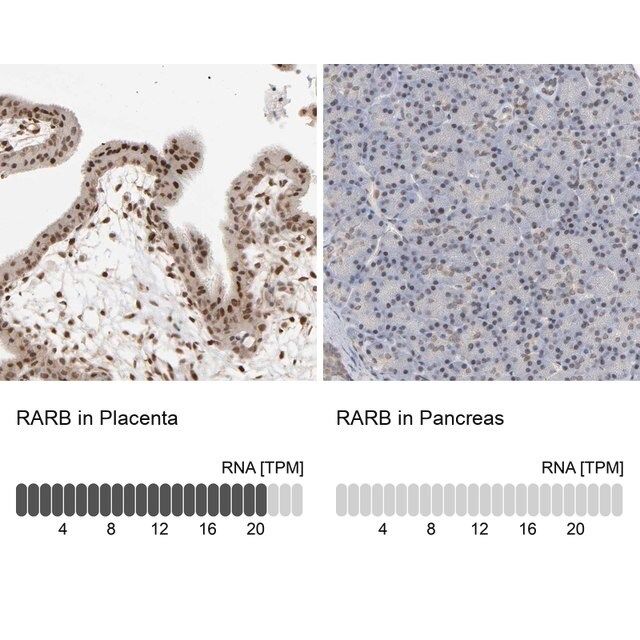 Anti-RARB antibody produced in rabbit