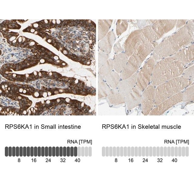 Anti-RPS6KA1 antibody produced in rabbit