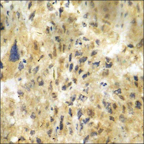 Anti-phospho-CDK5 (pTyr<sup>15</sup>) antibody produced in rabbit