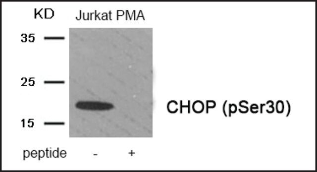 Anti-phospho-CHOP (pSer<sup>30</sup>) antibody produced in rabbit