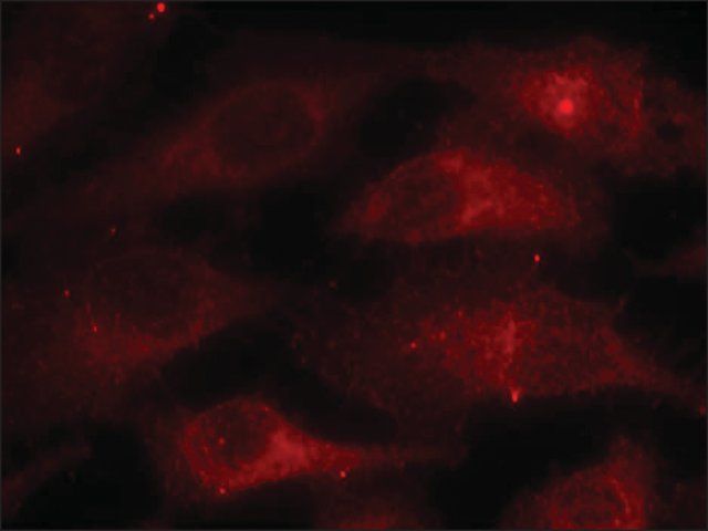 Anti-phospho-CAV1 (pTyr<sup>14</sup>) antibody produced in rabbit