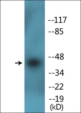 Anti-phospho-CDK9 (pThr<sup>186</sup>) antibody produced in rabbit