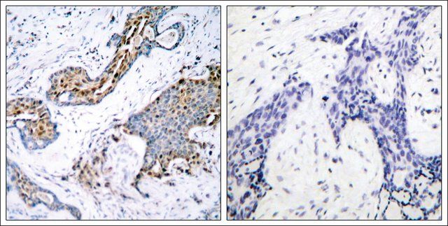 Anti-phospho-ESR1 (pSer<sup>118</sup>) antibody produced in rabbit