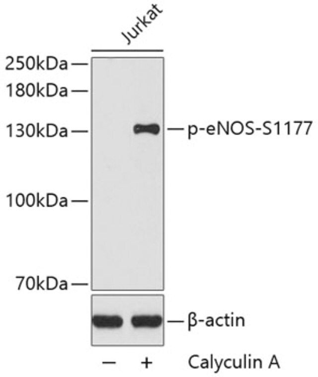 Anti-Phospho-eNOS-S1177 antibody produced in rabbit