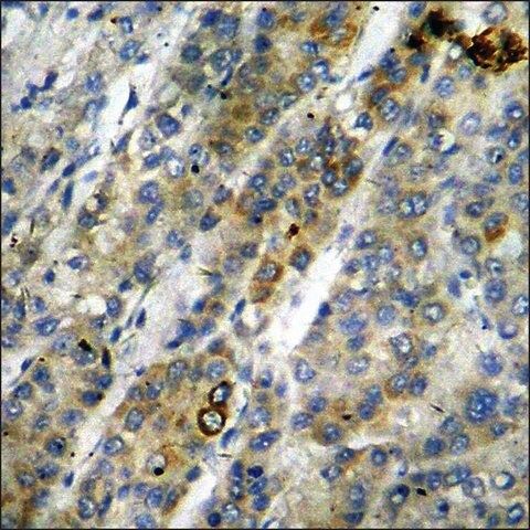 Anti-phospho-Estrogen Receptor-α (pSer<sup>305</sup>) antibody produced in rabbit