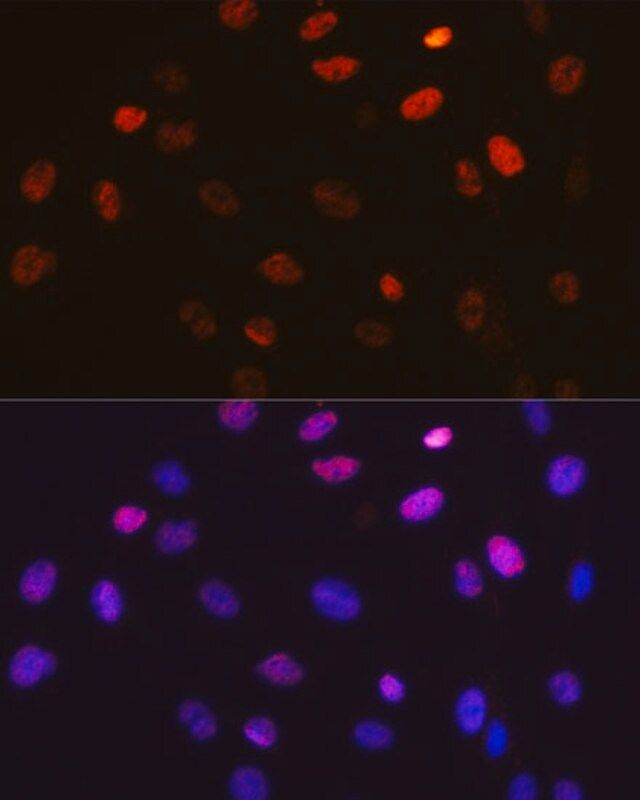Anti-Phospho-c-Jun-S63 antibody produced in rabbit