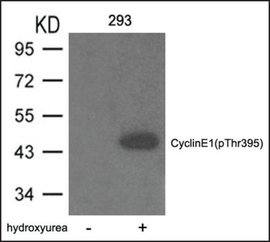 Anti-phospho-Cyclin E1 (pThr<sup>395</sup>) antibody produced in rabbit