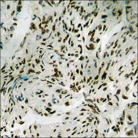 Anti-phospho-Elk1 (pThr<sup>417</sup>) antibody produced in rabbit