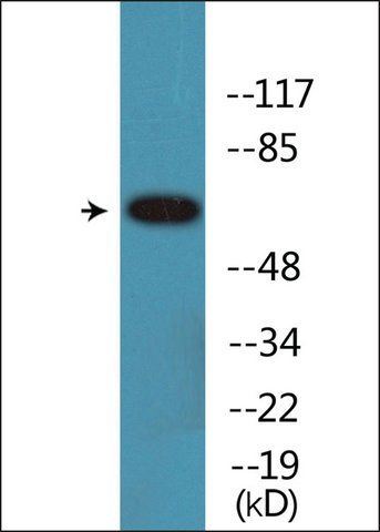 Anti-phospho-Estrogen Receptor-α (pSer<sup>104</sup>) antibody produced in rabbit