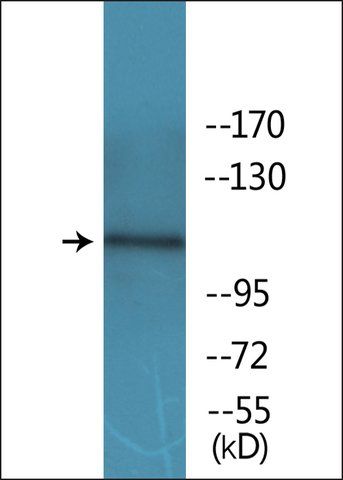 Anti-phospho-EPHB1/2 (pTyr<sup>594/604</sup>) antibody produced in rabbit