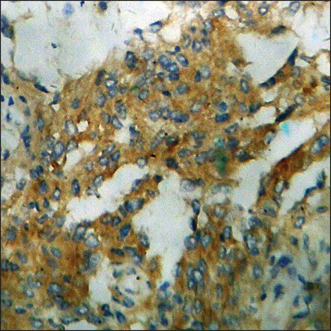 Anti-phospho-IL-8R β/CDw128 β (pSer<sup>347</sup>) antibody produced in rabbit