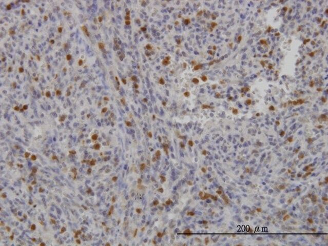 ANTI-FGR antibody produced in mouse