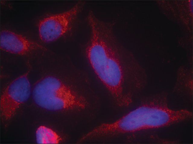Anti-FLT3 (Ab-591) antibody produced in rabbit