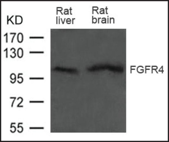 Anti-FGFR4 antibody produced in rabbit