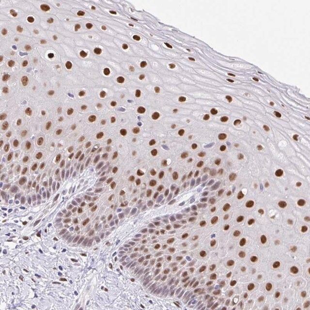 Anti-FOSL2 antibody produced in rabbit