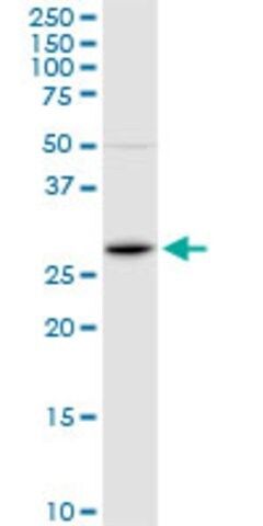 Anti-FOSL1 antibody produced in rabbit