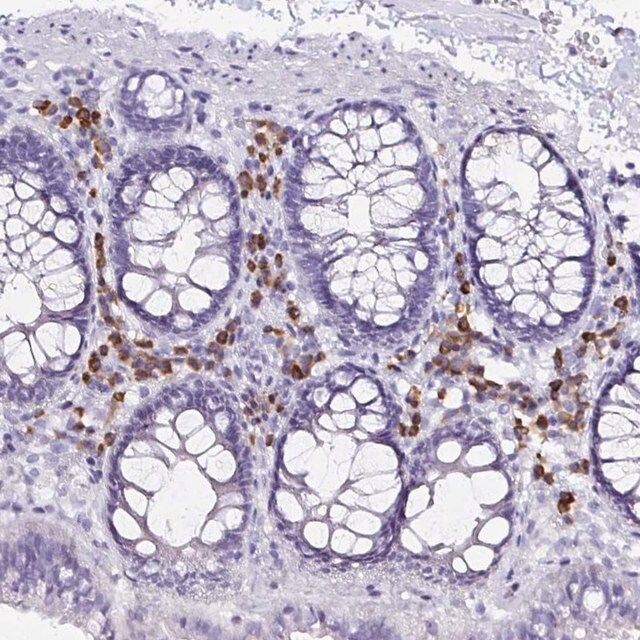 Anti-FNTB antibody produced in rabbit