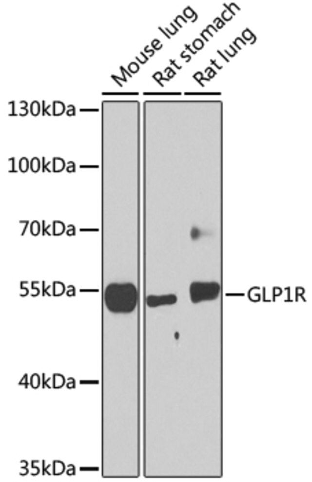 Anti-GLP1R antibody produced in rabbit
