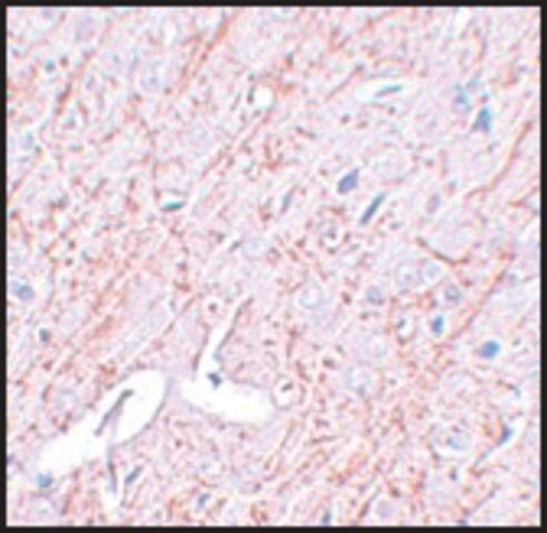 Anti-GATA3 antibody produced in rabbit