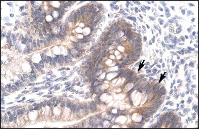 Anti-FOSL2 antibody produced in rabbit
