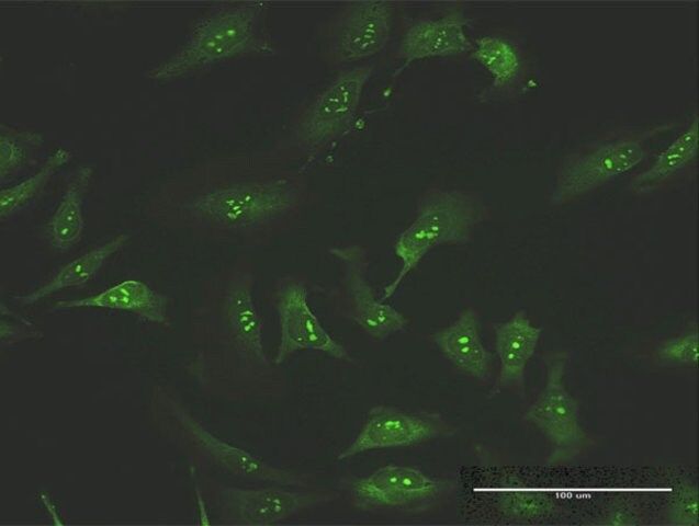 Anti-FNTA antibody produced in mouse