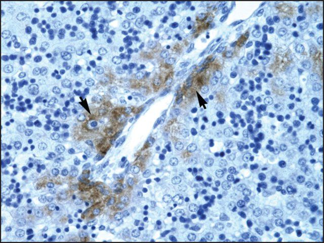 Anti-GATA3 antibody produced in rabbit
