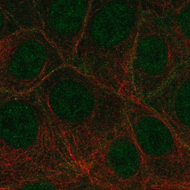 Anti-FLT4 antibody produced in rabbit