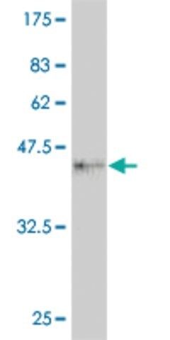 ANTI-FOXM1 antibody produced in mouse