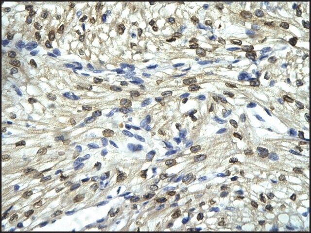 Anti-FLI1 antibody produced in rabbit