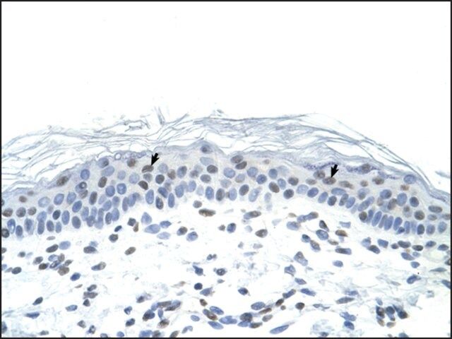 Anti-FOSL1