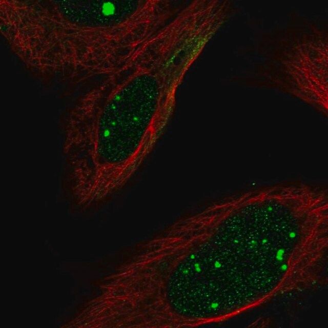 Anti-FLI1 antibody produced in rabbit
