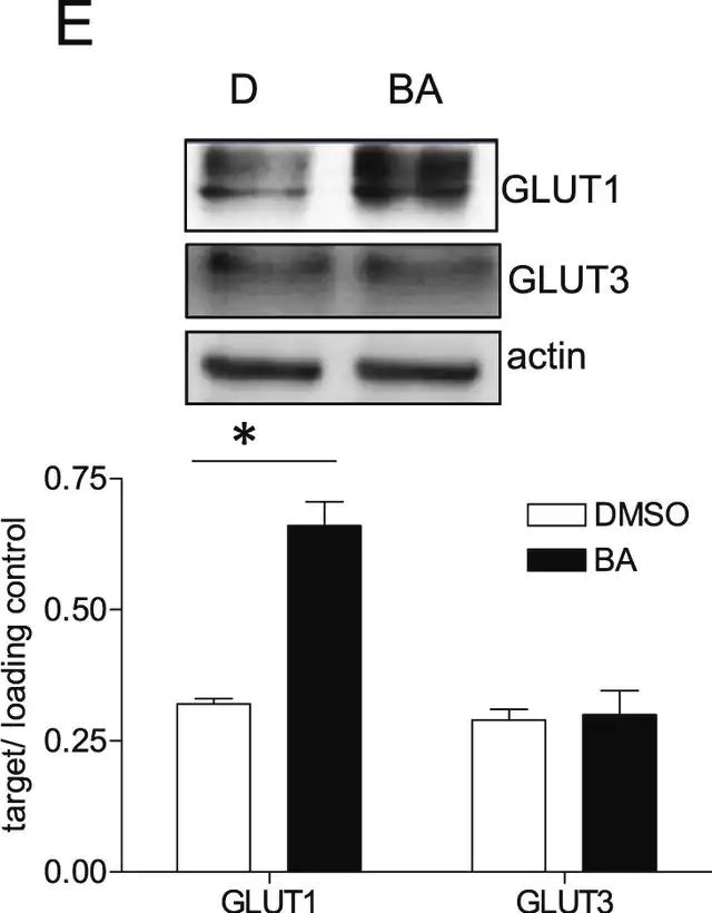 Anti-Glucose Transporter GLUT-1 Antibody, CT