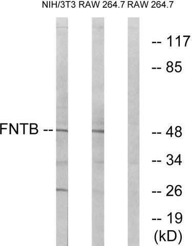 Anti-FNTB antibody produced in rabbit
