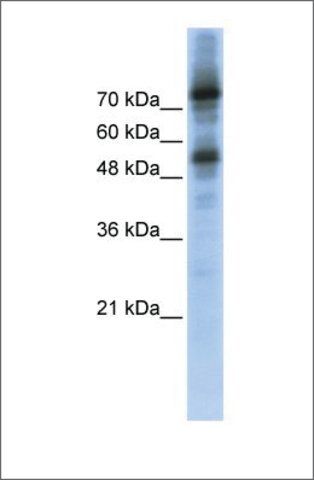 Anti-FOXM1 (ab2) antibody produced in rabbit