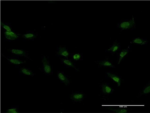 ANTI-FOXM1 antibody produced in mouse