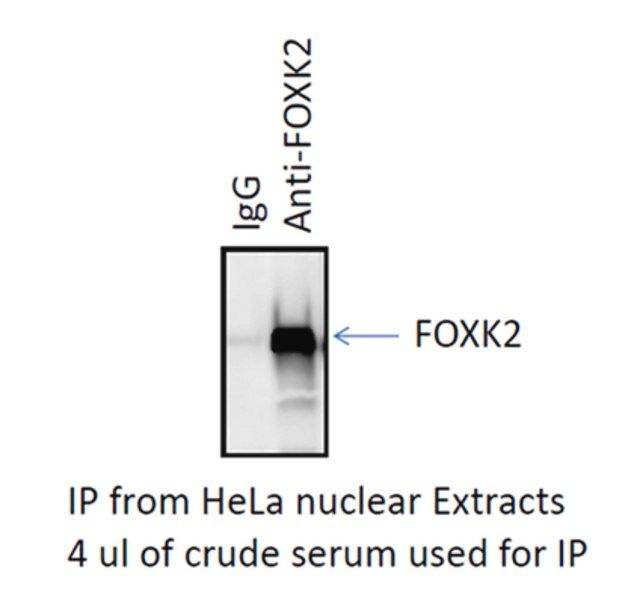Anti-FOXK2 Antibody