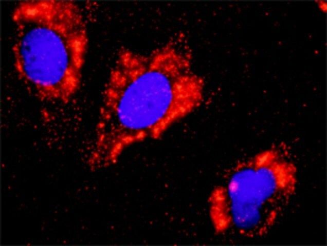 Anti-FLT1 antibody produced in rabbit