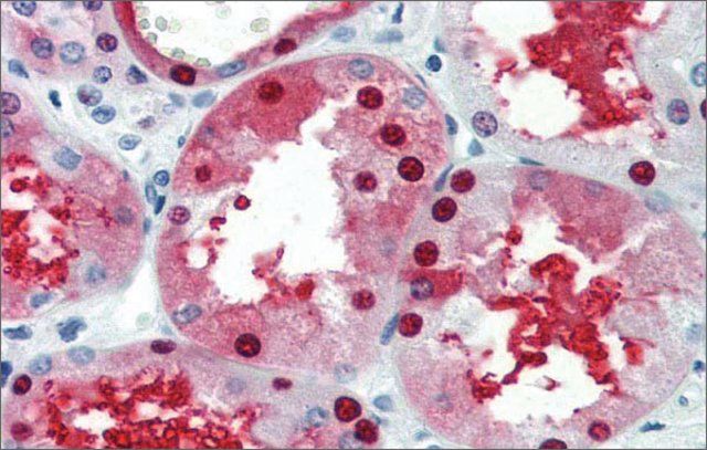 Anti-GATA3 antibody produced in rabbit