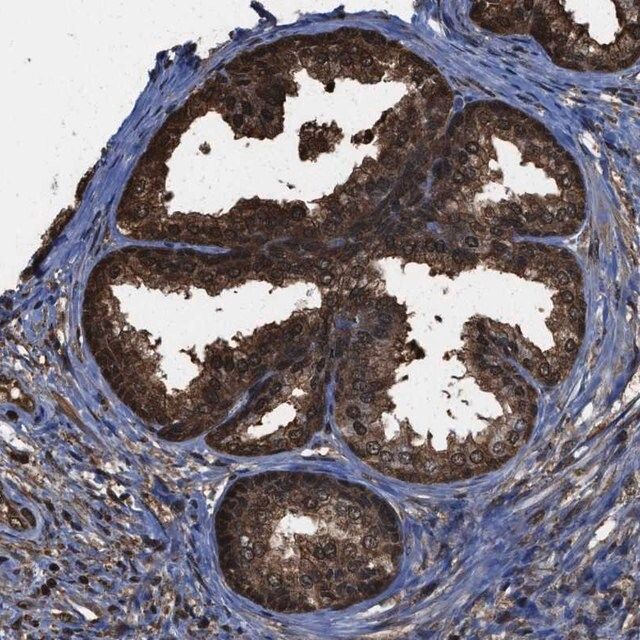 Anti-FNTA antibody produced in rabbit