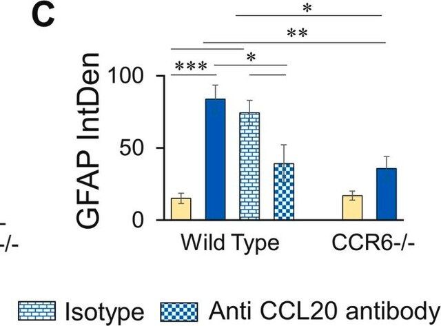 Anti-Glial Fibrillary Acidic Protein Antibody
