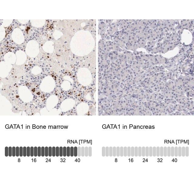 Anti-GATA1 antibody produced in rabbit