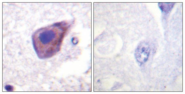 Anti-Gz-α antibody produced in rabbit