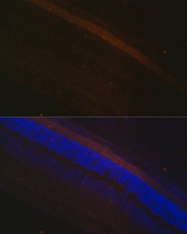 Anti-GRK1 antibody produced in rabbit