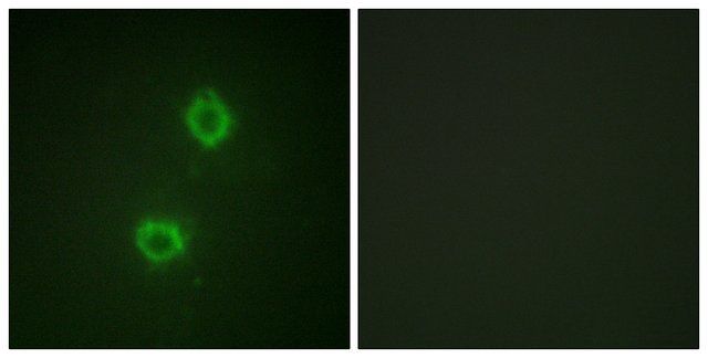 Anti-FGFR1 antibody produced in rabbit