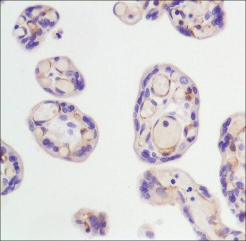 Anti-FLK-1 (mouse) antibody, Rabbit monoclonal