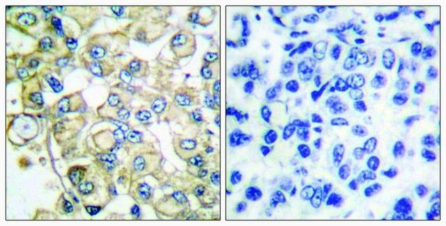 Anti-FGFR1 antibody produced in rabbit