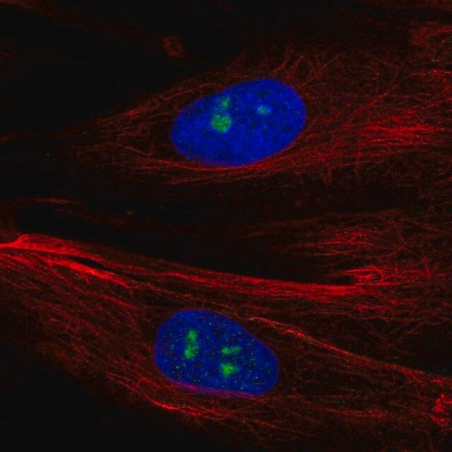 Anti-FGFR1 antibody produced in rabbit