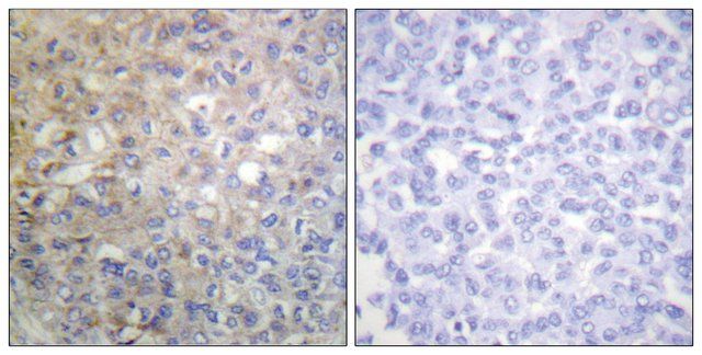 Anti-FGFR1 antibody produced in rabbit