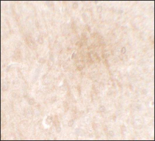 Anti-FGFR3 antibody produced in rabbit